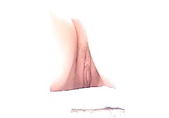 Hẹp mắt y tá, tạo ra một trang sex của nhật bản thuận lợi điều trị cho bệnh nhân